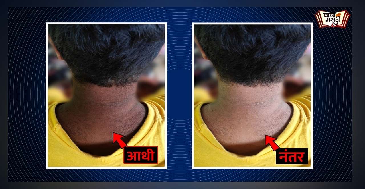 Effective and Natural Home Remedies To Get Rid Of A Dark Neck