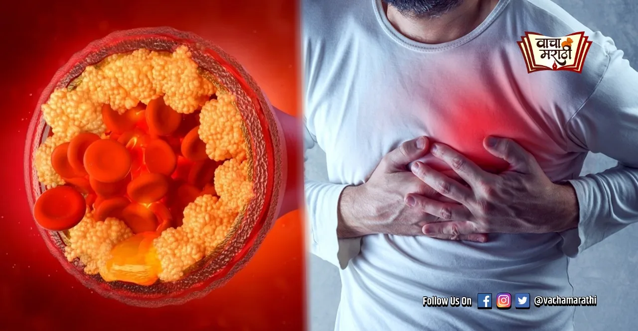 Foods can increase the cholesterol level in human body