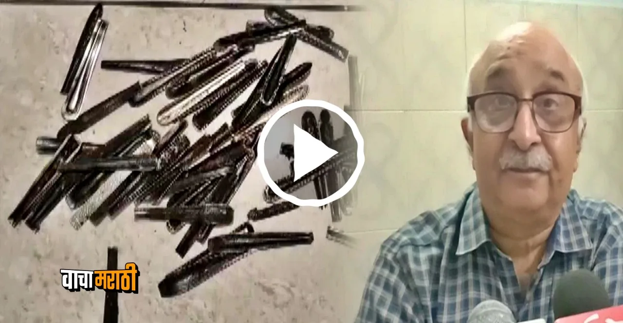 doctors found 62 steel spoons in the stomach of a patient in UP