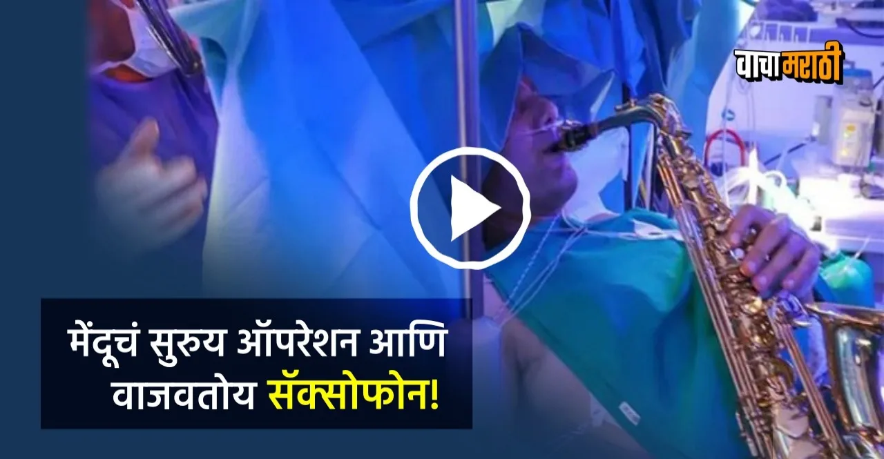 Patient playing saxophone during 9 hours brain surgery operation watch video