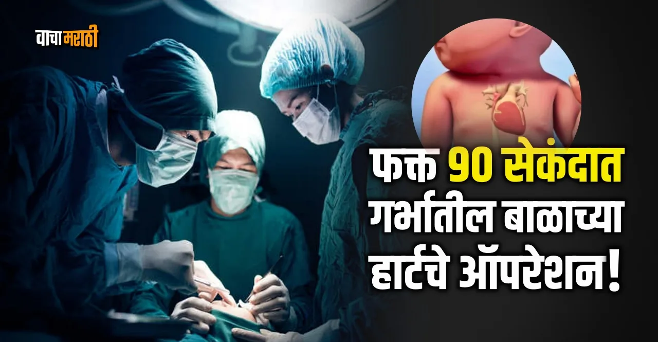 Delhi AIIMS Doctors Perform Risky Heart Surgery On Baby Inside Womb in 90 seconds