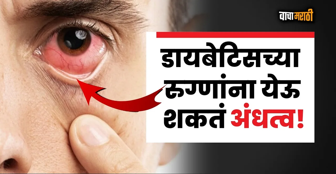 Diabetes Can Affect Eyes and Vision know about Diabetic Retinopathy