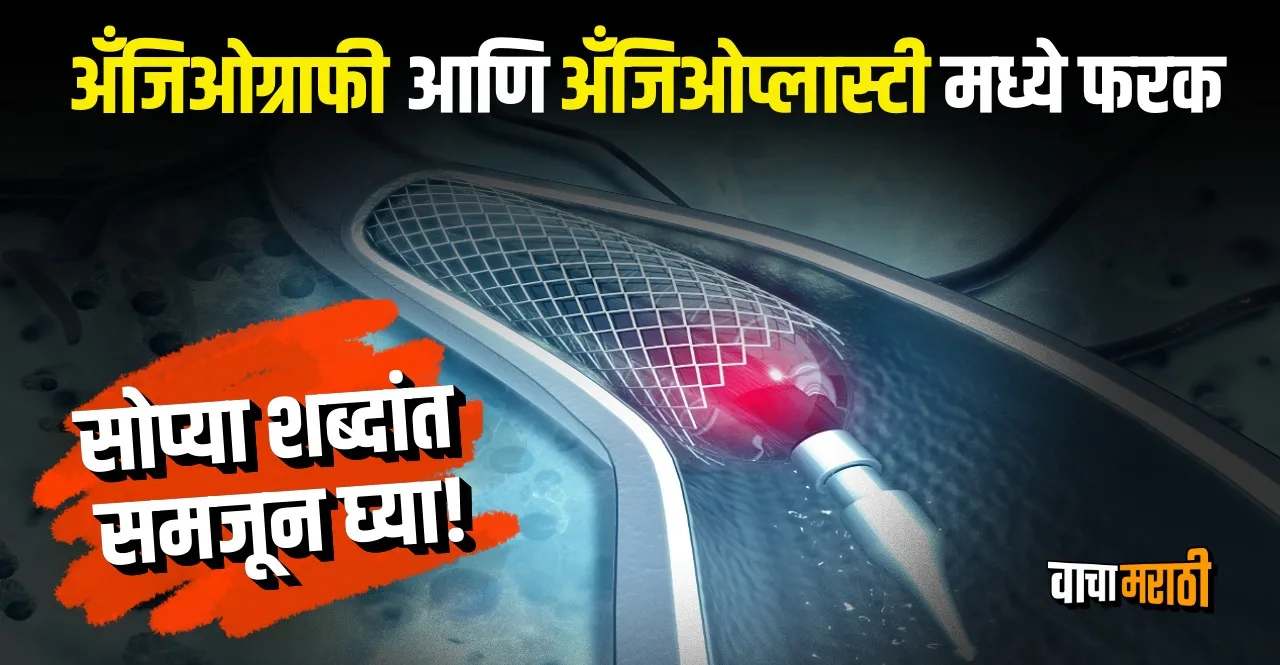 Know The Difference between Angiography and Angioplasty