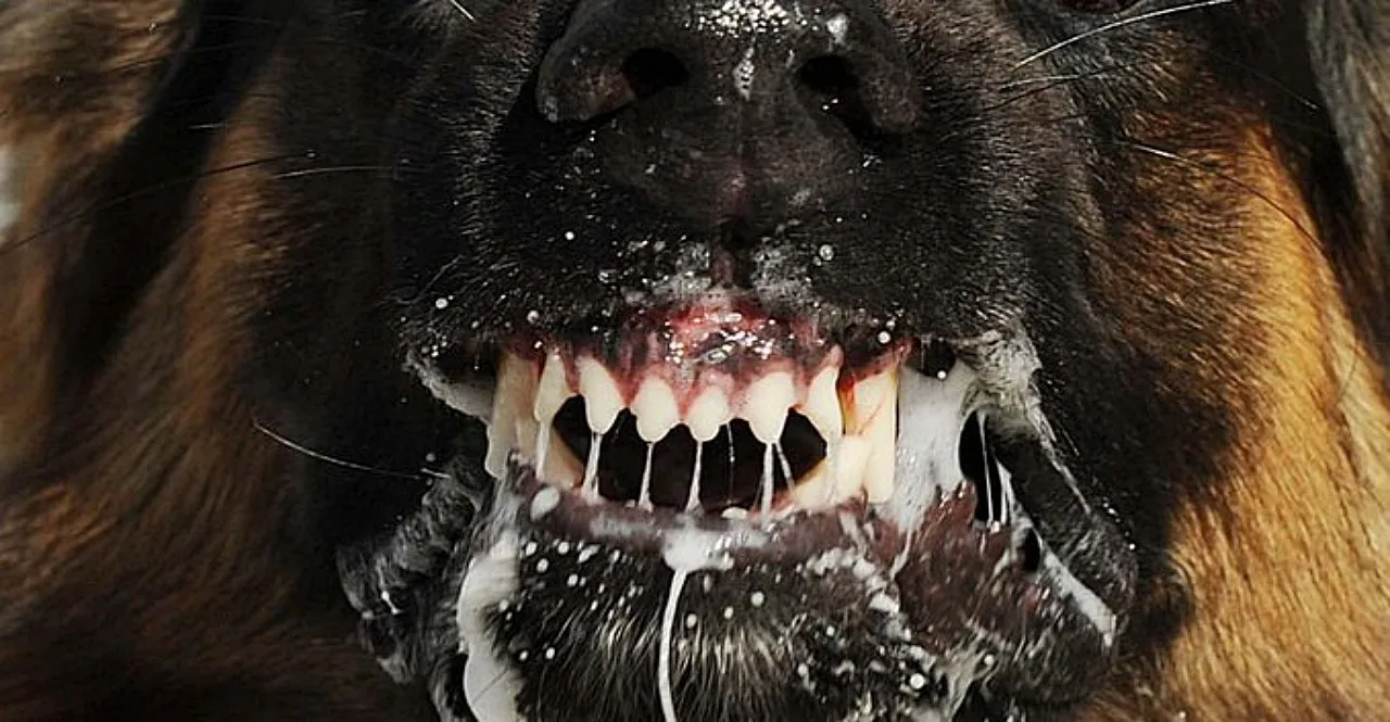 World Rabies Day Do 3 things immediately after dog bite