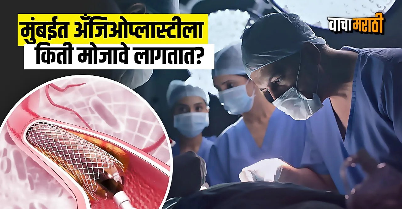 Cost of Angioplasty in Mumbai check here