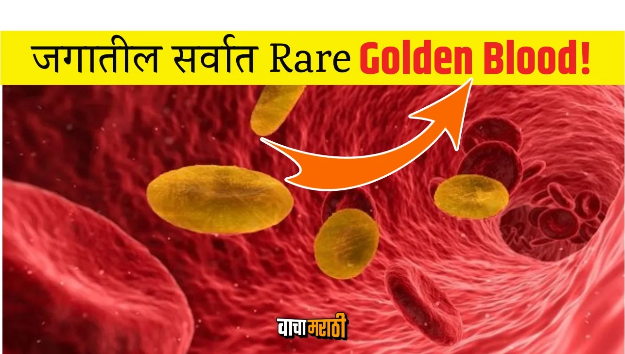 Know what is Golden blood type The rarest in the world