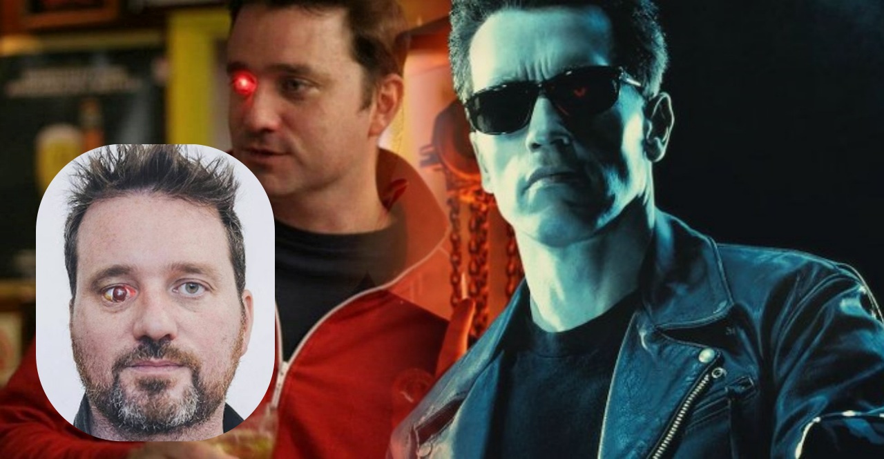 Real life Terminator Rob Spence got his eye removed and installed a wireless camera