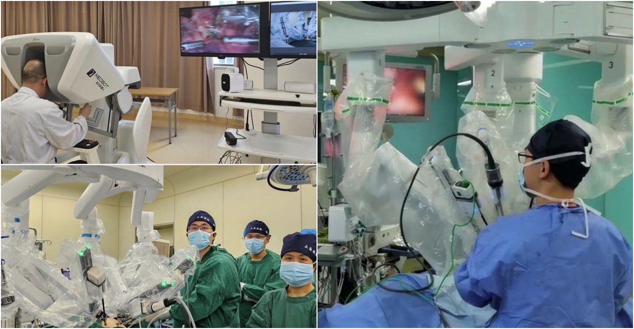 China doctor Team removes patient's lung tumor using robot from 5000 km away